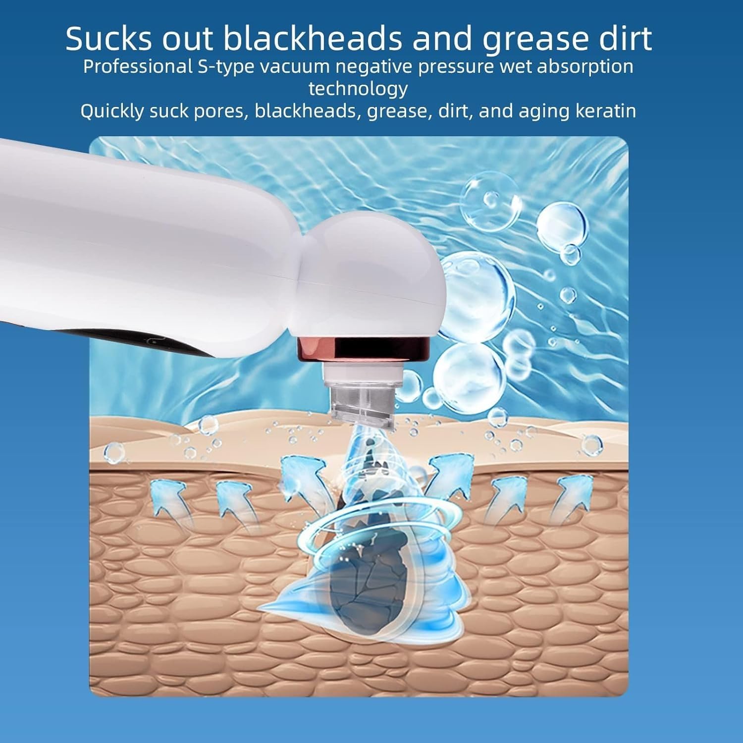 جهاز شفط الرؤوس السوداء الذكي لتنظيف البشرة – Smart Blackhead Remover Facial Device