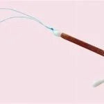 (Mirena) hormonal intrauterine device. اللولب الرحمي الهرموني ميرينا (Mirena).